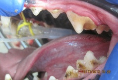 Снятие зубных отложений ультразвуковым скалером.